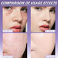 🤩 🤩 🤩 VANDAAG VOORDAT VOORDAT UITVERKOCHT! 👇🎁Matterende Concealer voor Gezicht en Lichaam